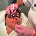 restylane eriksbergskliniken restylane eriksbergskliniken fillers skönhet